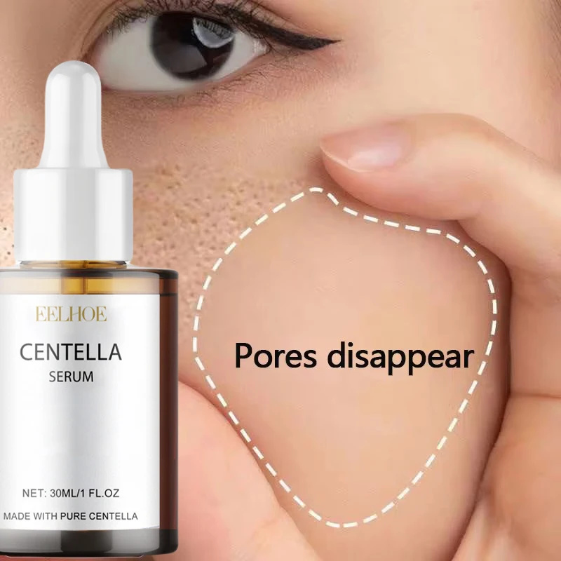 Centella Asiatica Toner - Centella Asiatica Face Serum Nourish Dry