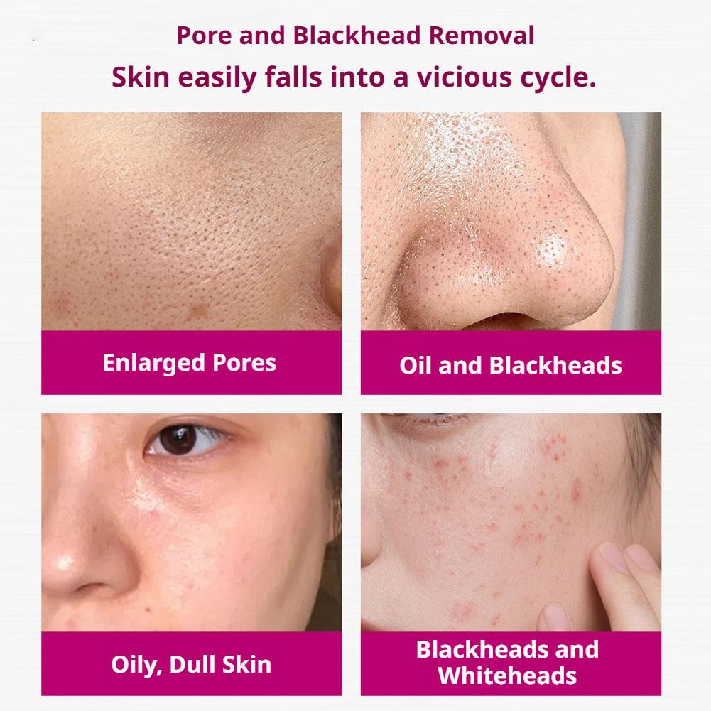 Salicylic Acid Shrink Pores Se - Glycolic Acid Exfoliant ulasan dan harga