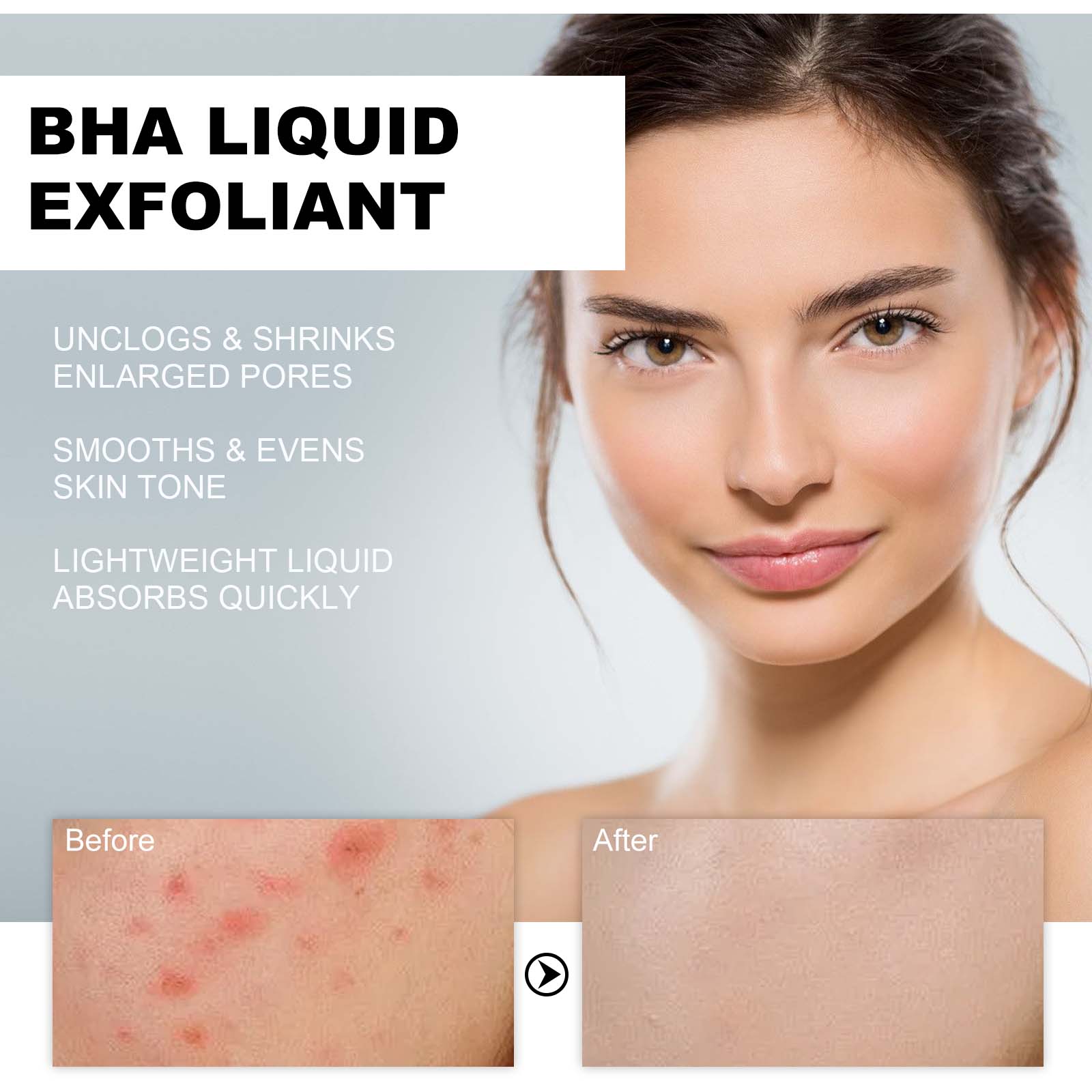 2% Salicylic Acid Liquid Exfol - Glycolic Acid Exfoliant ulasan dan harga