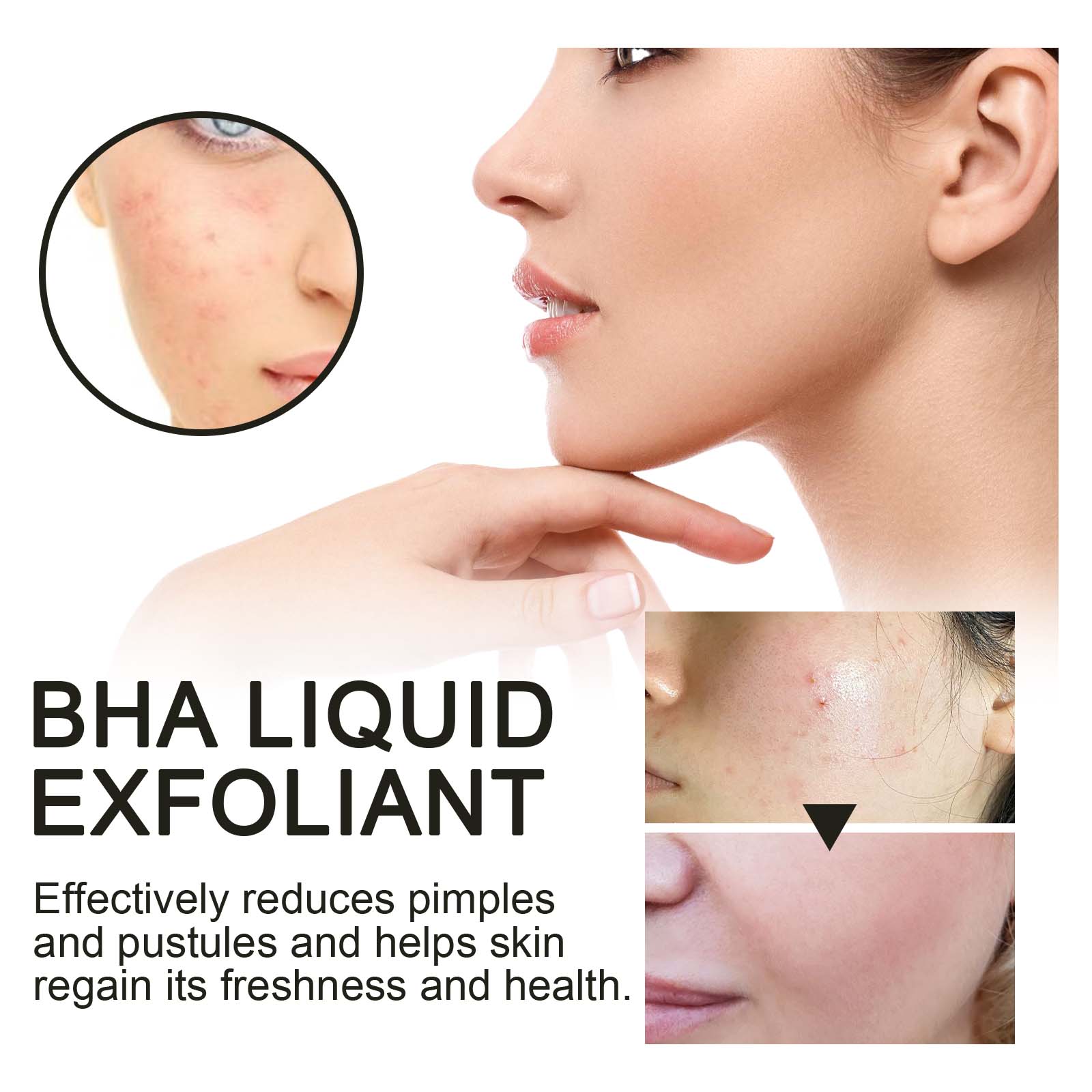 2% Salicylic Acid Liquid Exfol - Glycolic Acid Exfoliant ulasan dan harga