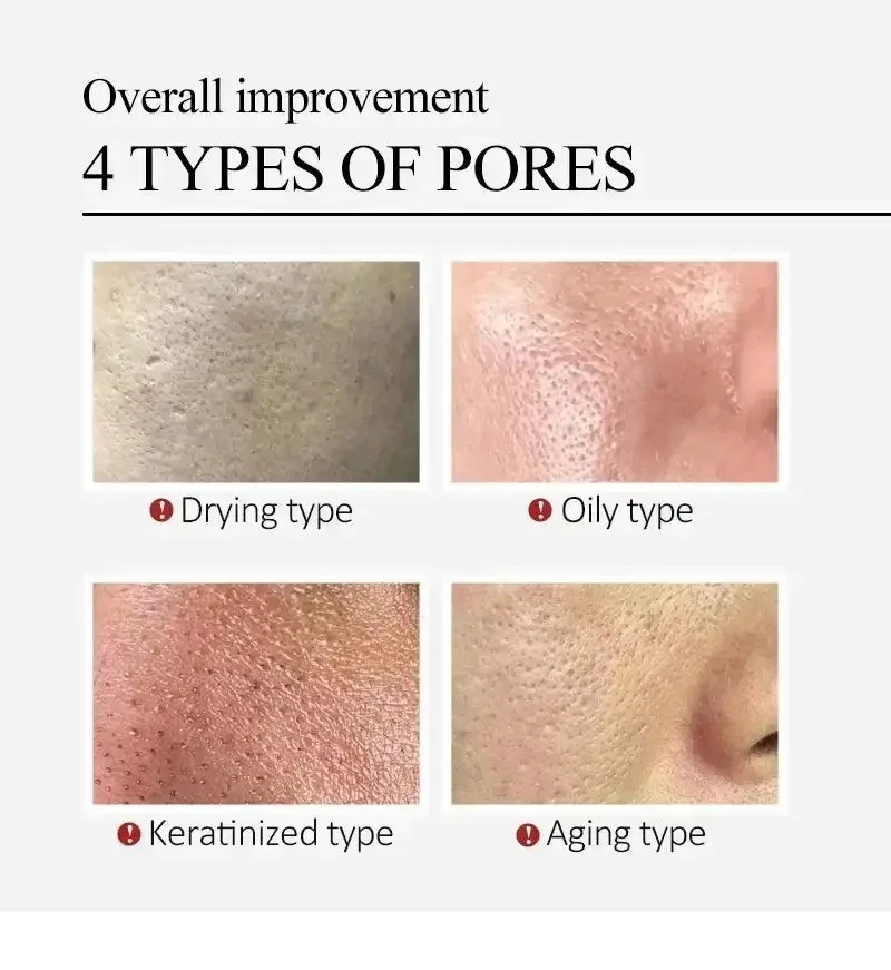 Centella Asiatica Shrink Pores - Centella Asiatica Toner ulasan dan harga